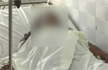 Fourth Acid Attack On Rape Survivor, Just Few Steps Away From Guard
